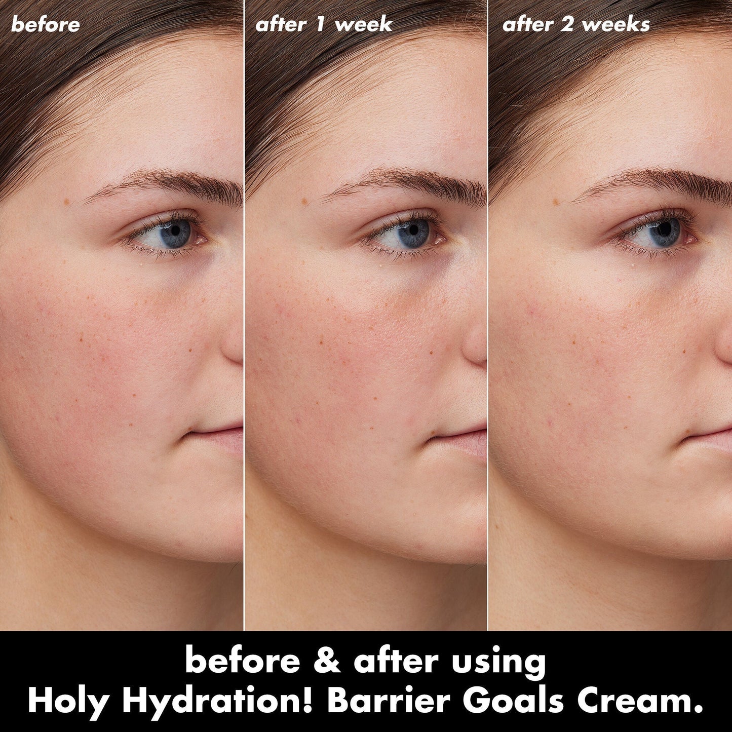 holy-hydration-barrier-goals-cream-mini-c2 0226_EDU_HHBarrierGoalsCream_B_A_Zoe_TRYPTICH_4f0e5b5d-35fb-4020-968e-244d4536afbd.jpg