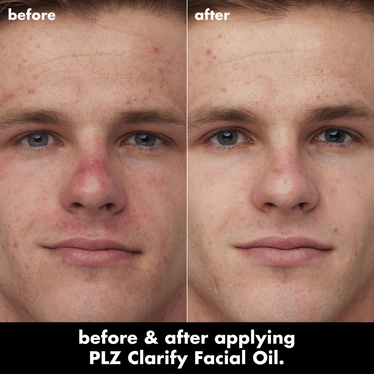 plz-clarify-facial-oil-a1 0326_EDU_PlzClarify_BA_Caleb.jpg