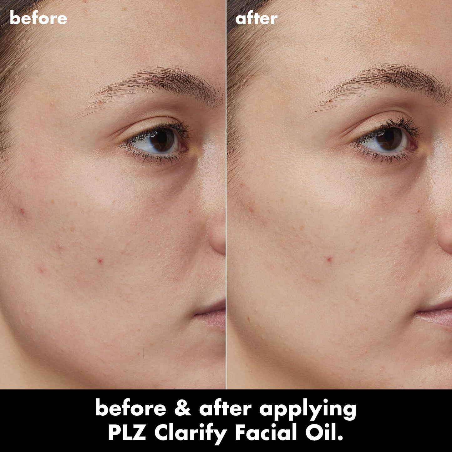 plz-clarify-facial-oil-a1 0326_EDU_PlzClarify_BA_Kelly.jpg
