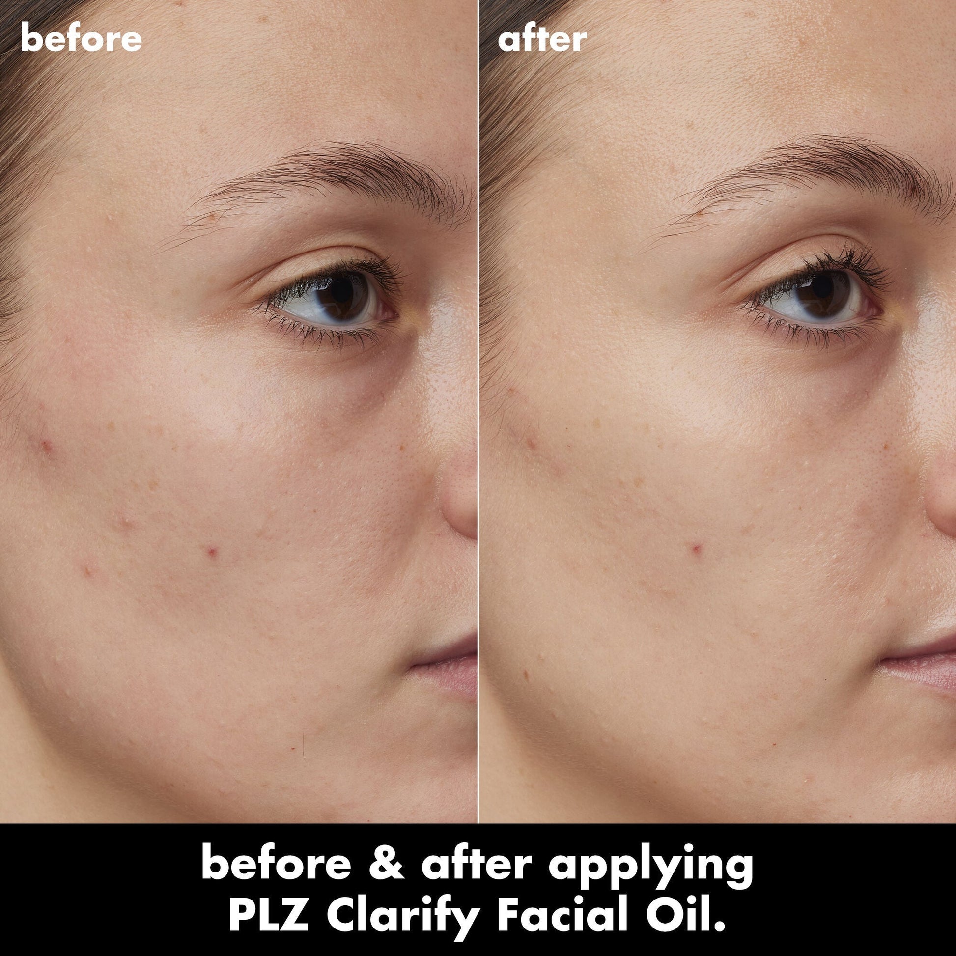 plz-clarify-facial-oil-a1 0326_EDU_PlzClarify_BA_Kelly.jpg