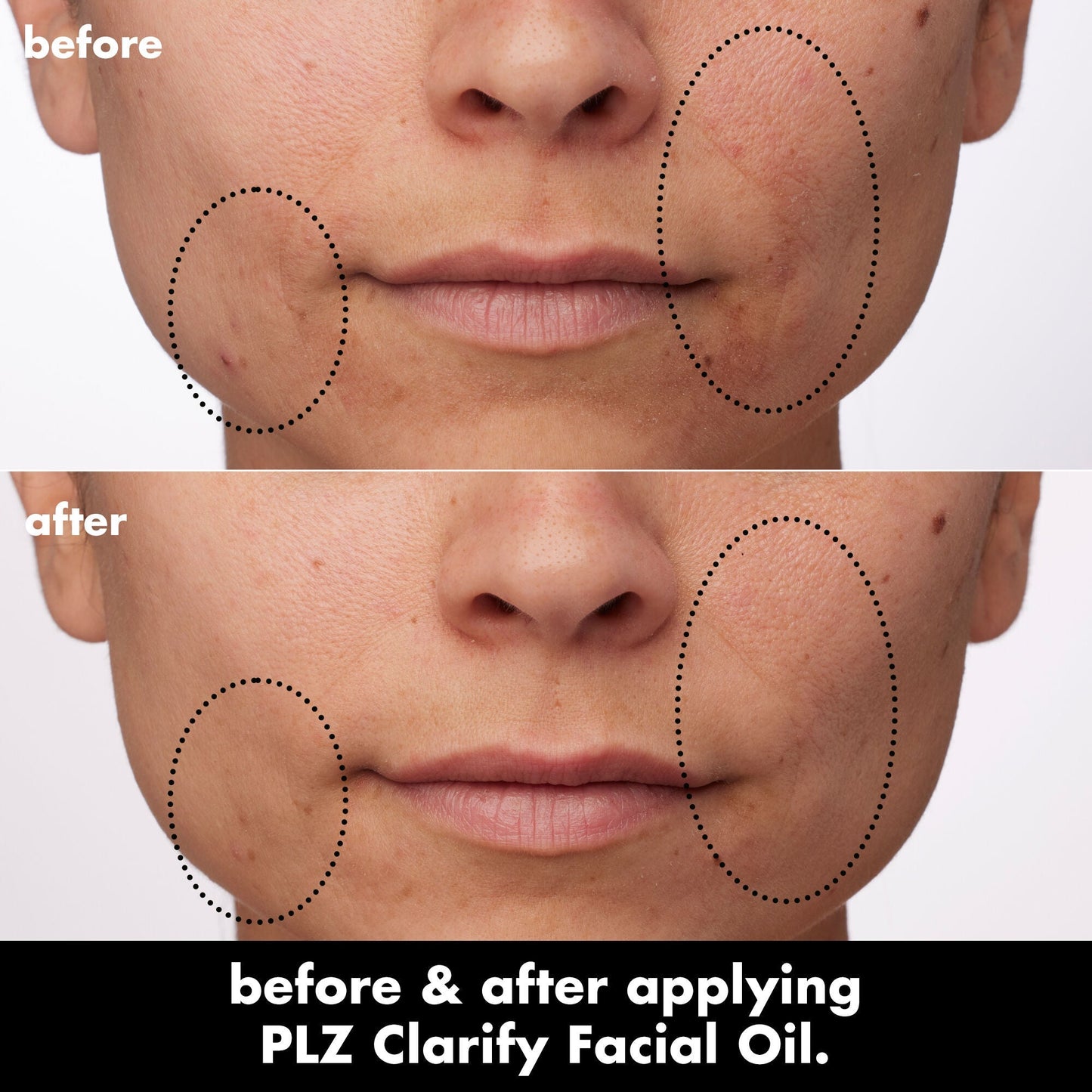 plz-clarify-facial-oil-a1 0326_EDU_PlzClarify_BA_Paula.jpg