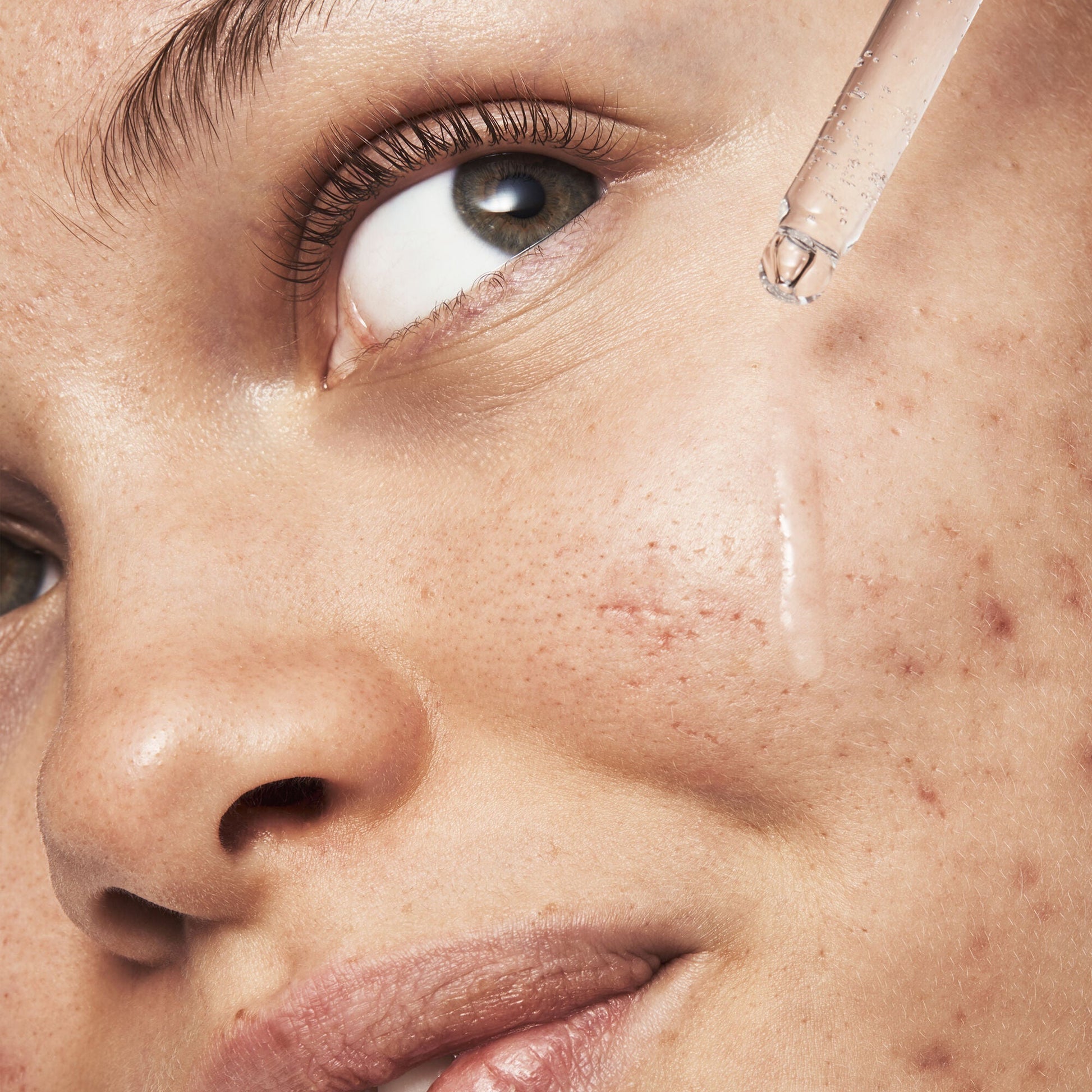blemish-breakthrough-triple-acid-resurfacing-serum-i8 121321_Marley-Acne-Regimen_0254_FINAL_IGF.jpg